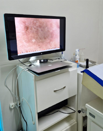 Diagnóstico com Videodermatoscopia de alta definição